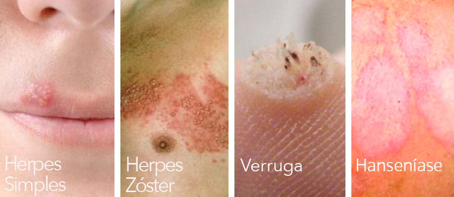 Doenças infecciosas